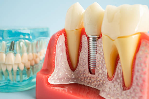 Best Dental Inlays and Onlays  in Cambridge, MA